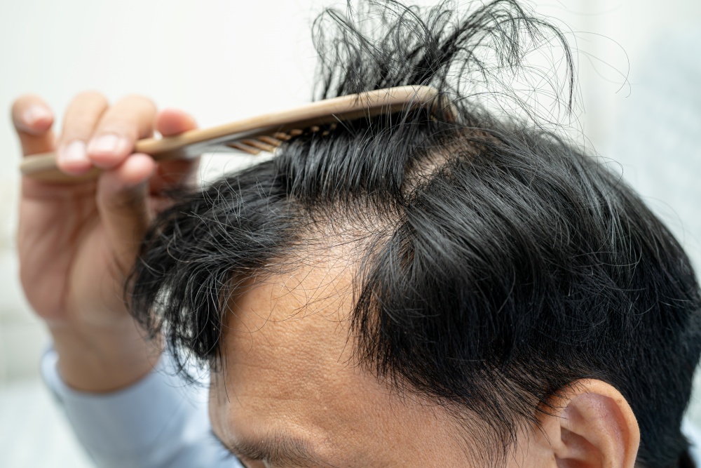 Bald in the middle head and begin no loss hair glabrous of matur