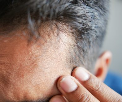 Can You Go Bald After a Hair Transplant? Understanding Post-Procedure Hair Changes