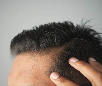 What Is DHT? Signs, Effects on Hair Loss, & How to Reduce It