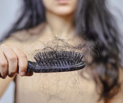 Female hairloss problems